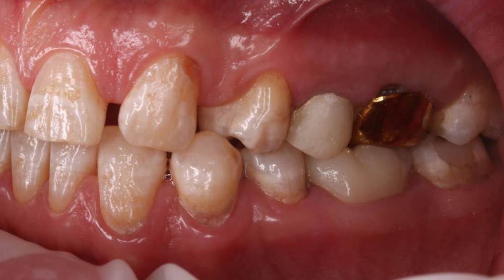 Роман Р. М. от 02.02.2021 0 00 00 2 и 3 сегмент.jpg