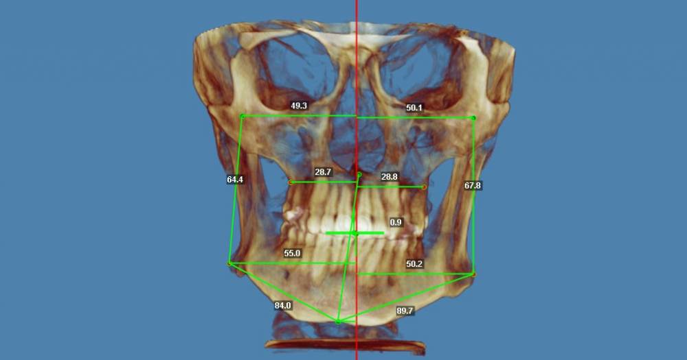 фронтальный расчет.jpg