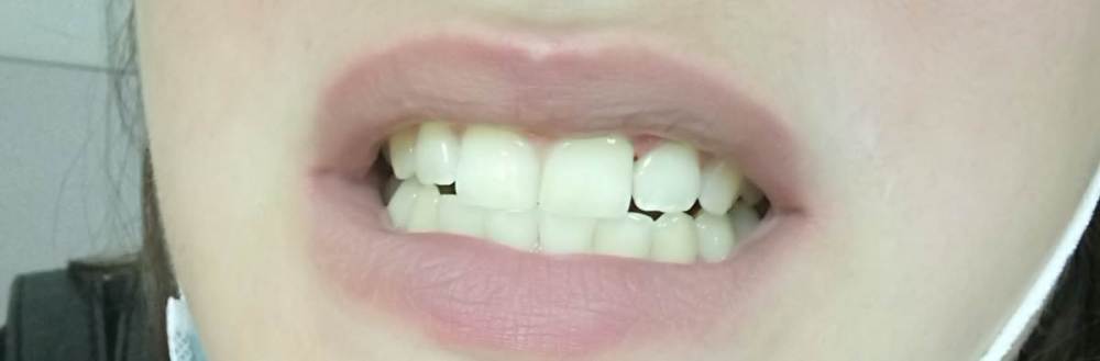 11.06 пломба 2 2.JPG