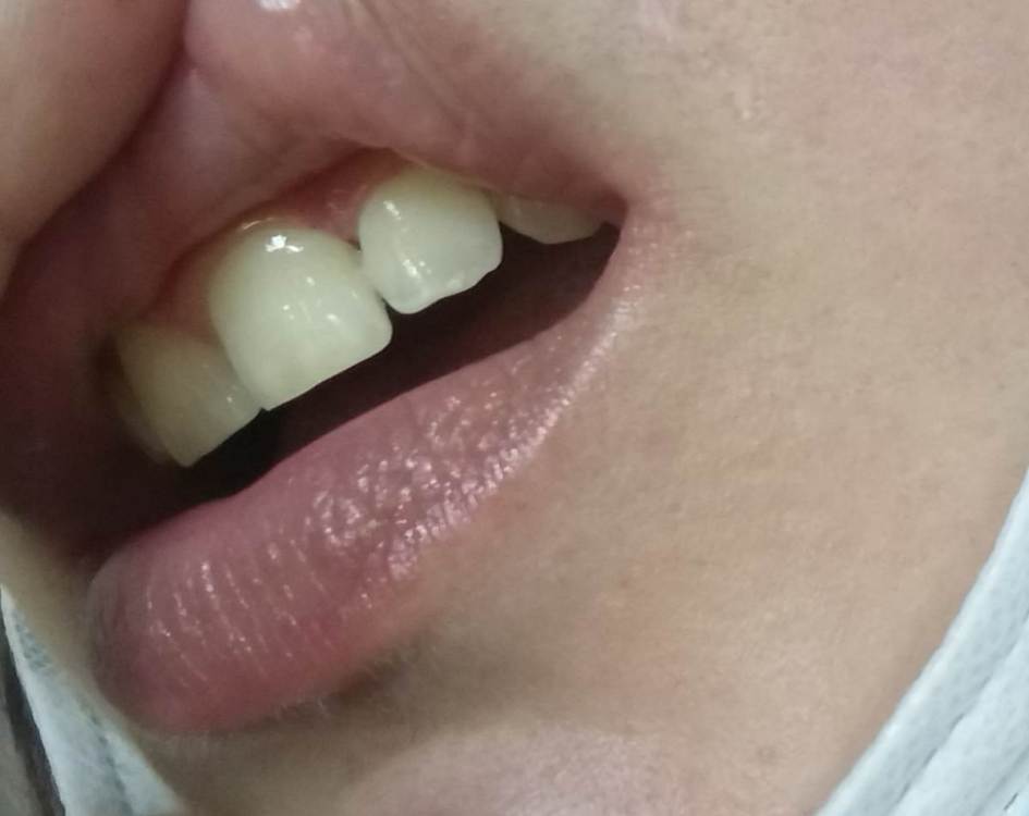 11.06 пломба 2.jpg