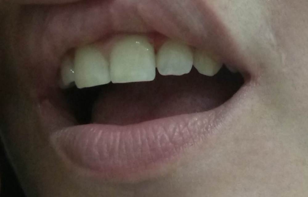 11.06 пломба 2 1.jpg