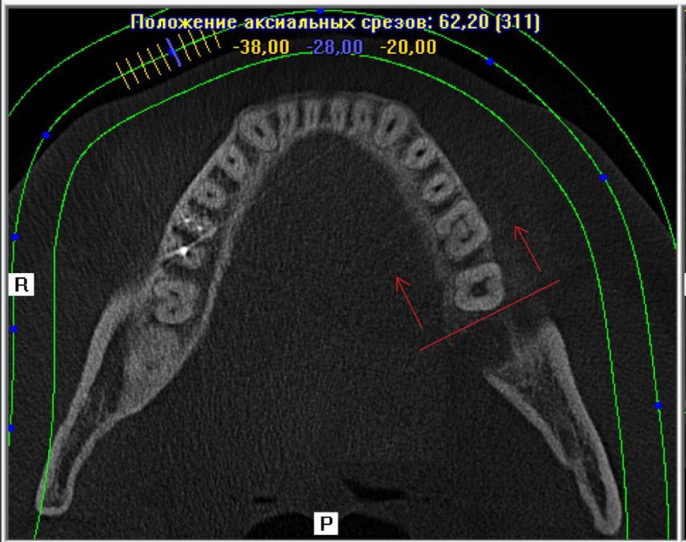 Плоскость ряда.jpg