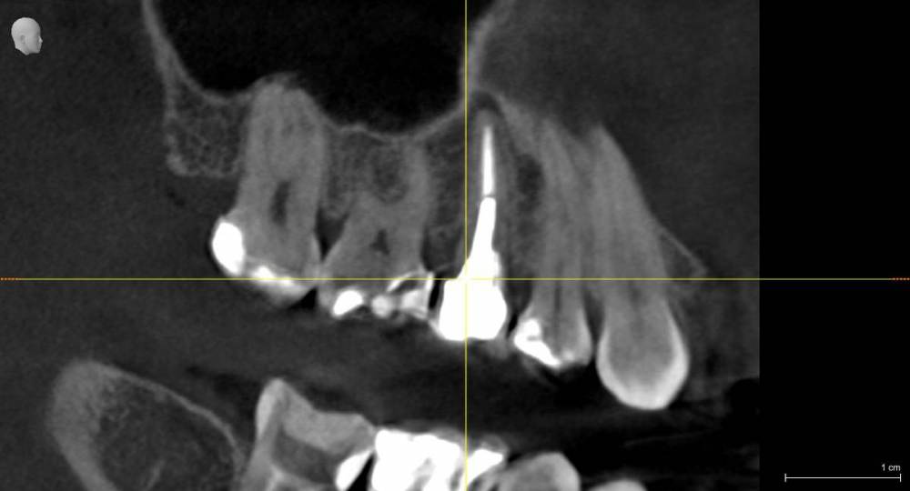 Iljaseviciene_Lina_3D examination(3)_VO1_20210507_090920_Longitudinal.jpg