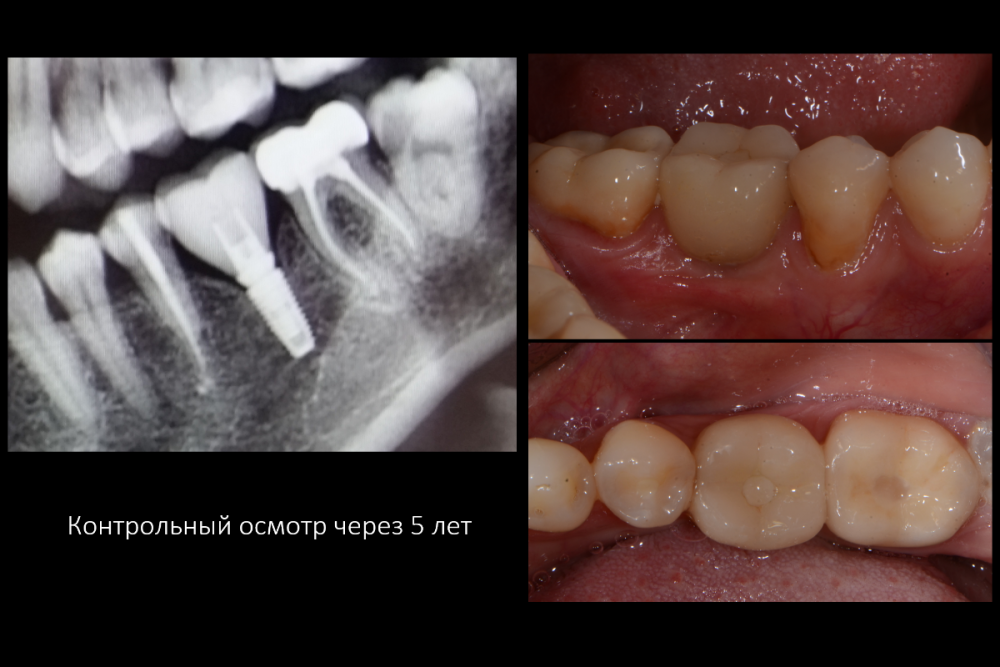 Снимок экрана (10).png