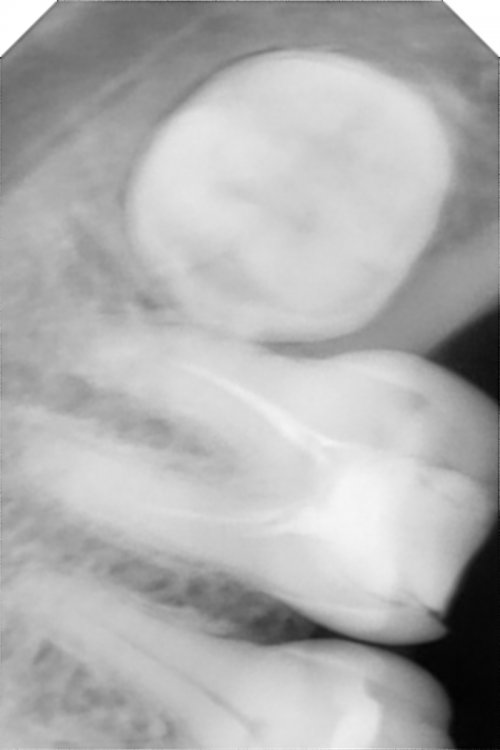 ZEN-X HD_01D771CACBDE.png