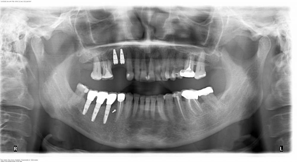 PSA 31.05.2021 Img#2.jpg