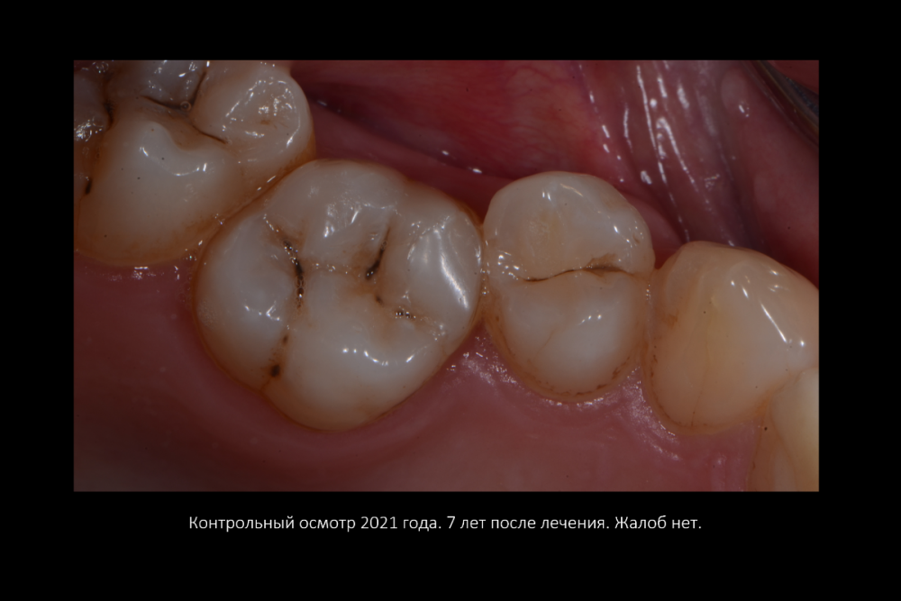 Снимок экрана (27).png