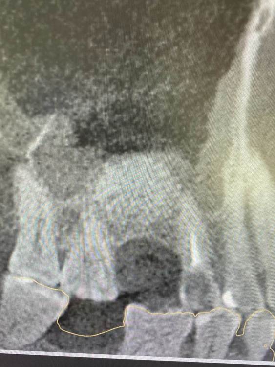 через 5 месяцев2.jpg