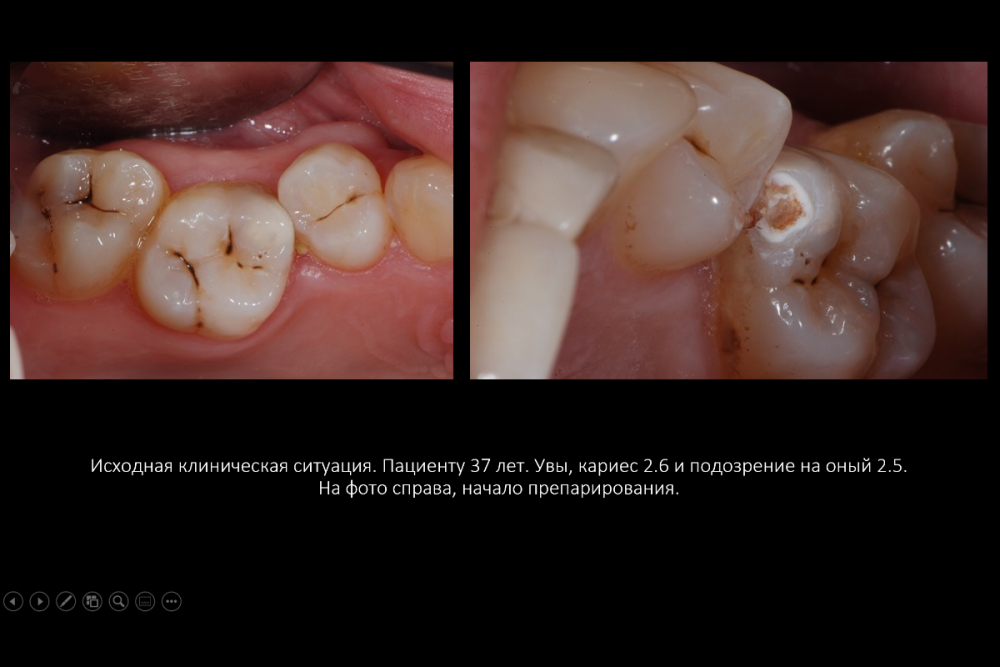 Снимок экрана (22).png