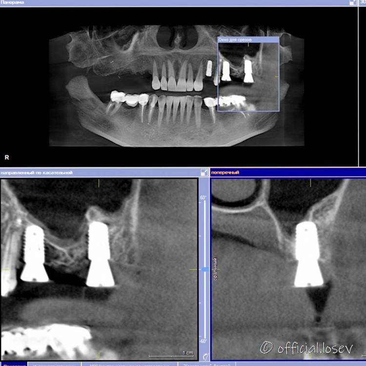 Новый точечный рисунок.jpg