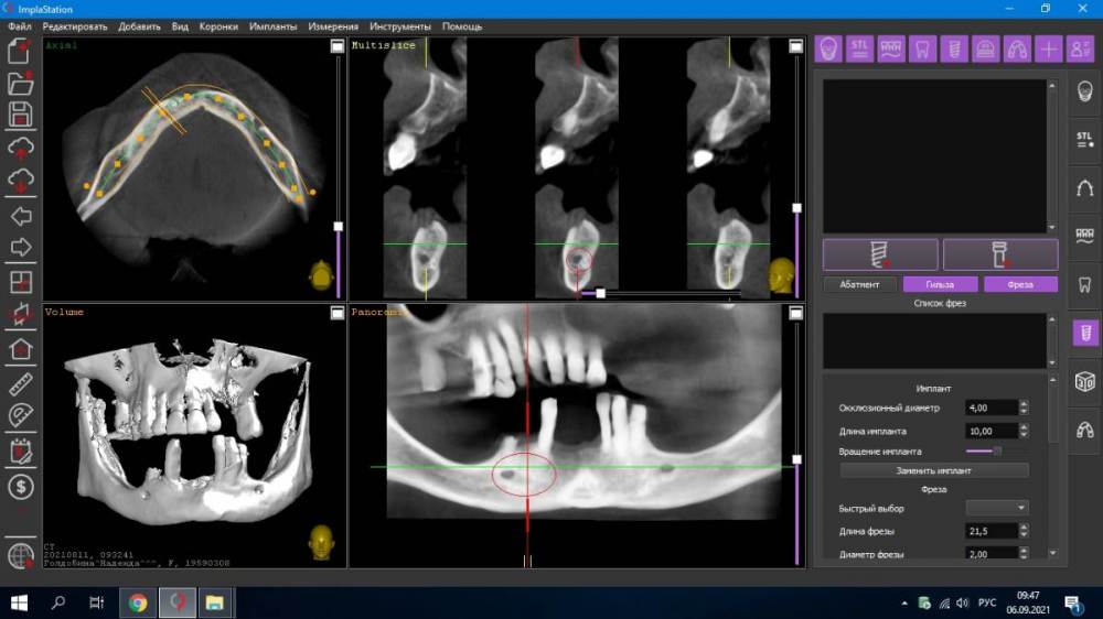 Ментале в 4 квадранте.jpg