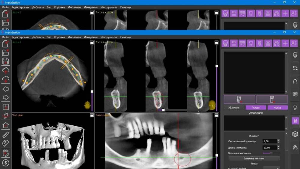Ментале в 3 квадранте.jpg