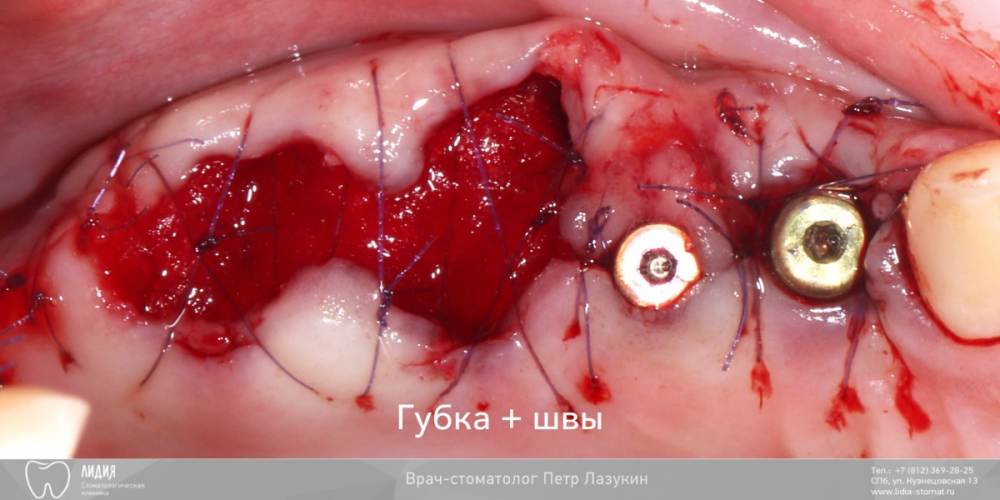 Без названия.006.jpeg