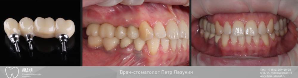 Без названия.009.jpeg