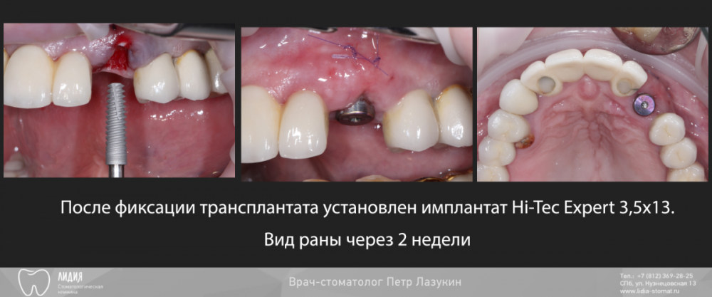 Калаганова публикация.006.png