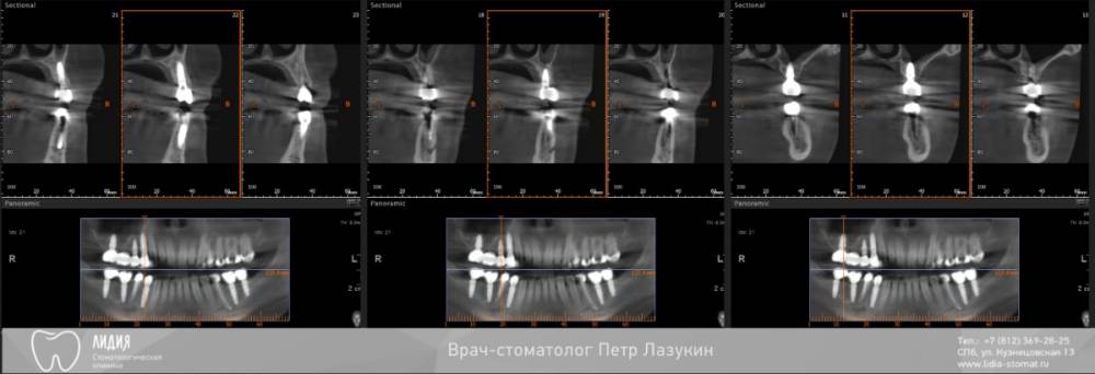Без названия.010.jpeg