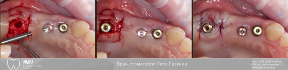 Без названия.008.jpeg