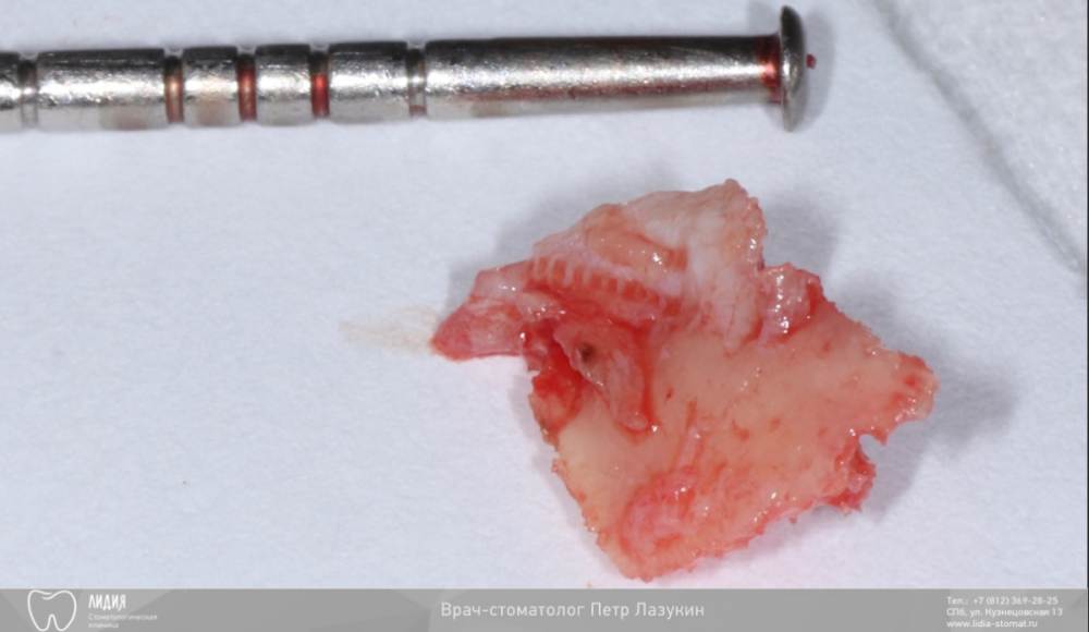 Без названия.004.jpeg