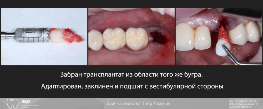 Калаганова публикация.005.png