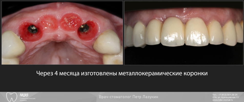 Калаганова публикация.003.png