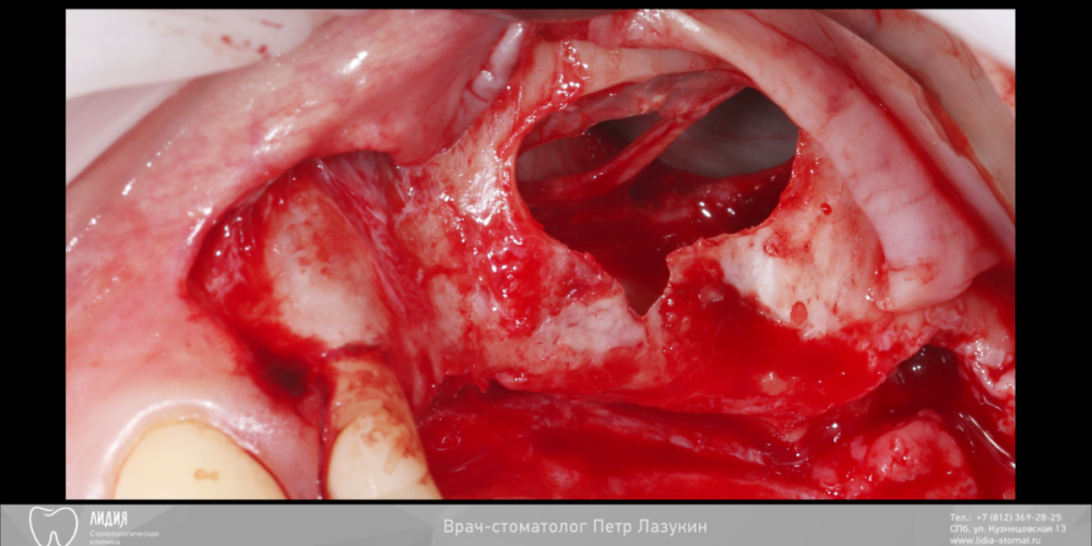 Без названия.002.png