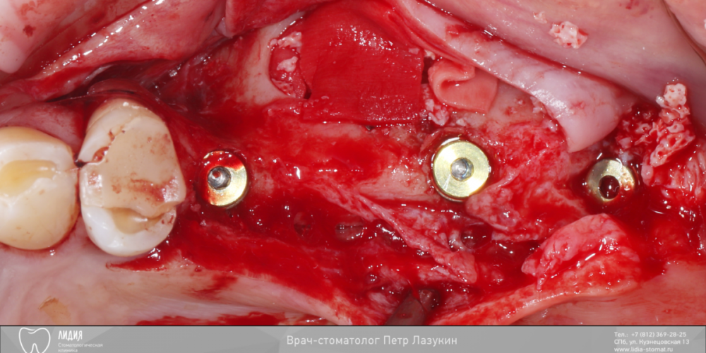 Без названия.006.png