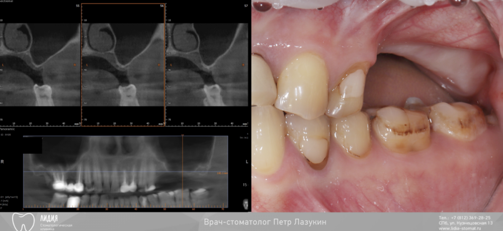 Без названия.001.png