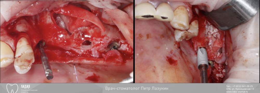 Без названия.005.png