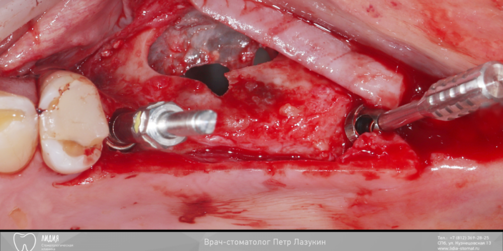 Без названия.003.png