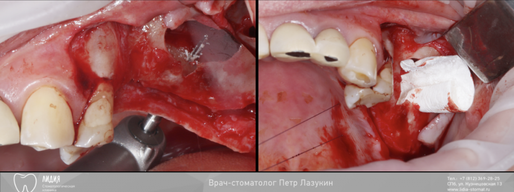 Без названия.004.png