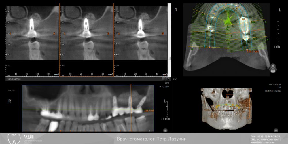 Без названия.008.png