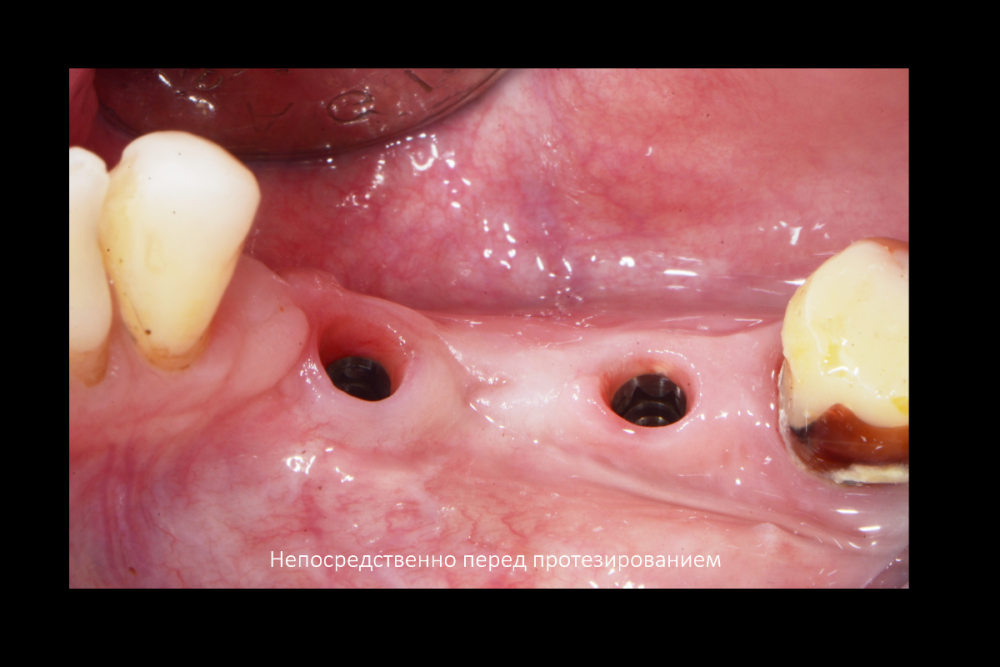 Снимок экрана (172).png