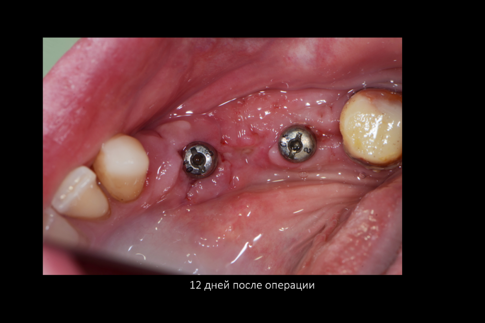 Снимок экрана (170).png