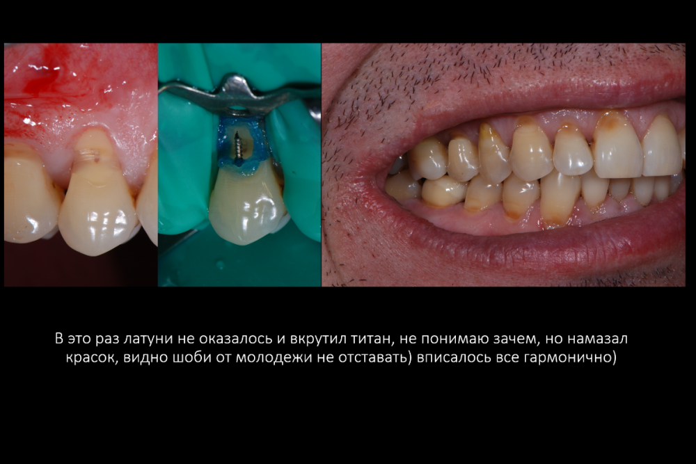 Снимок экрана (161).png