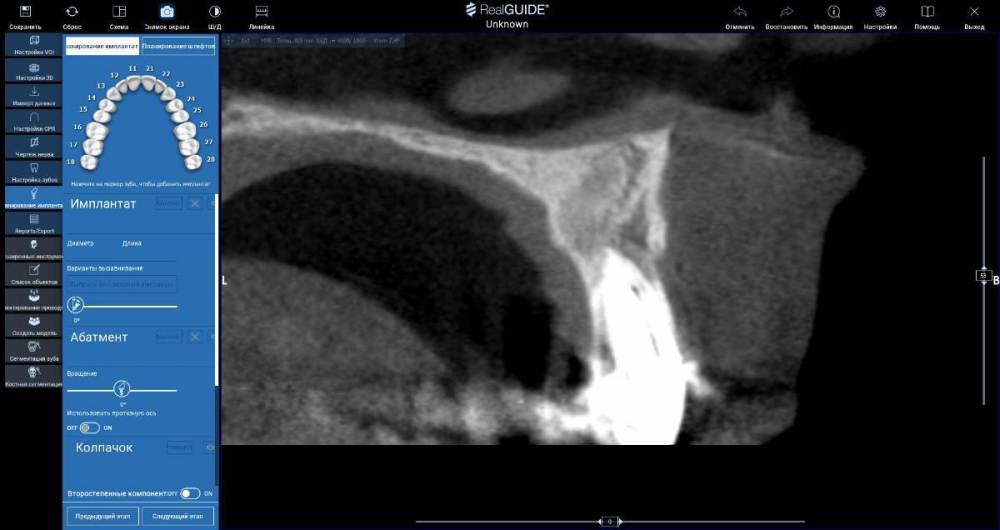 Арутюнян 21.jpg