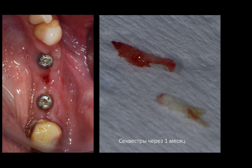 Снимок экрана (171).png