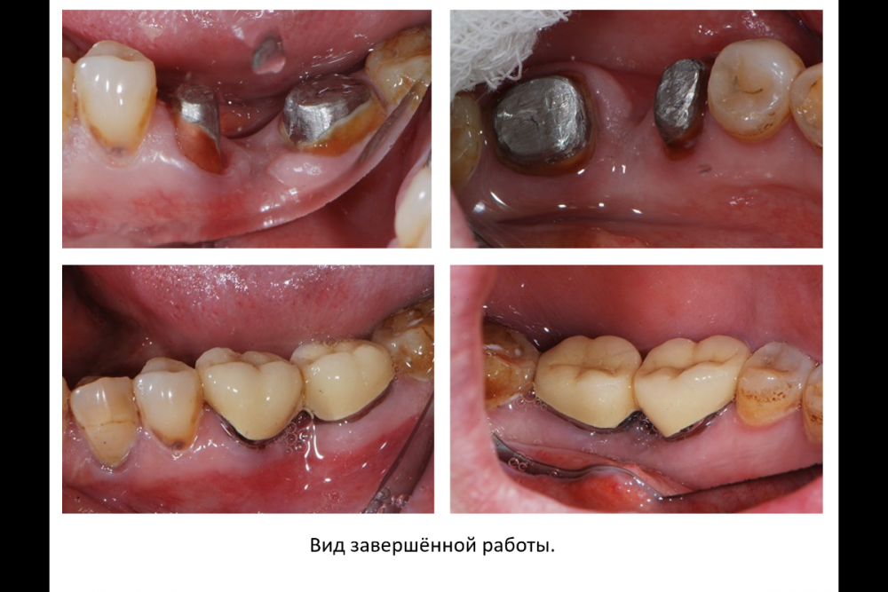 Снимок экрана (151).png
