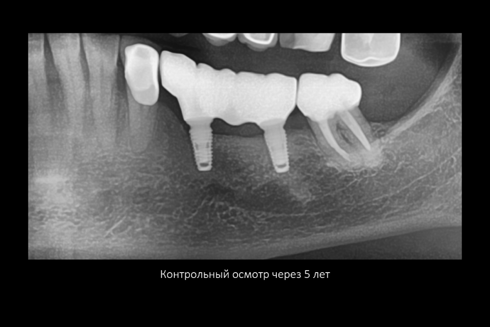 Снимок экрана (175).png
