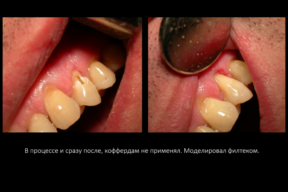 Снимок экрана (158).png