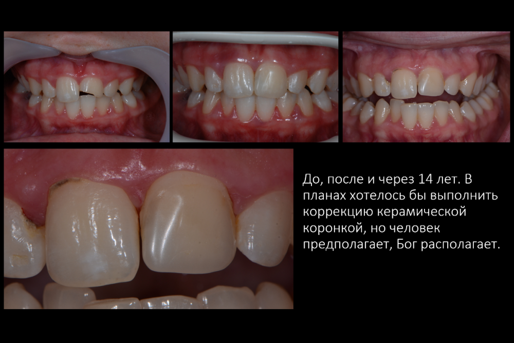 Снимок экрана (146).png