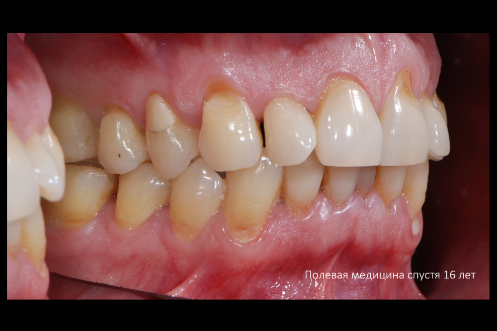 Снимок экрана (160).png