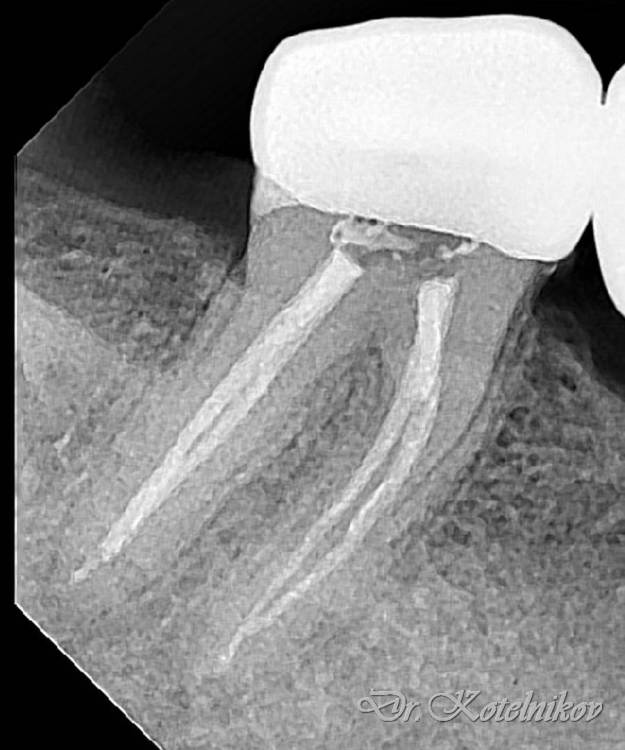 Чупахина 4.7-2.jpg