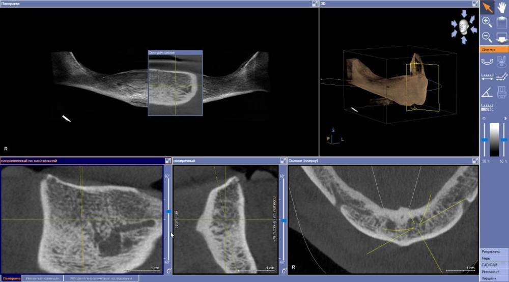 резцовая ветвь2.jpg