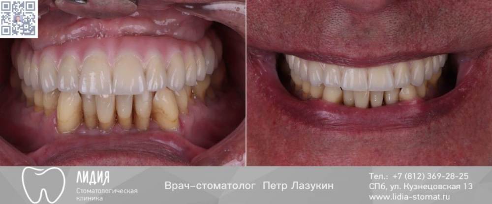 Без названия.010.jpeg