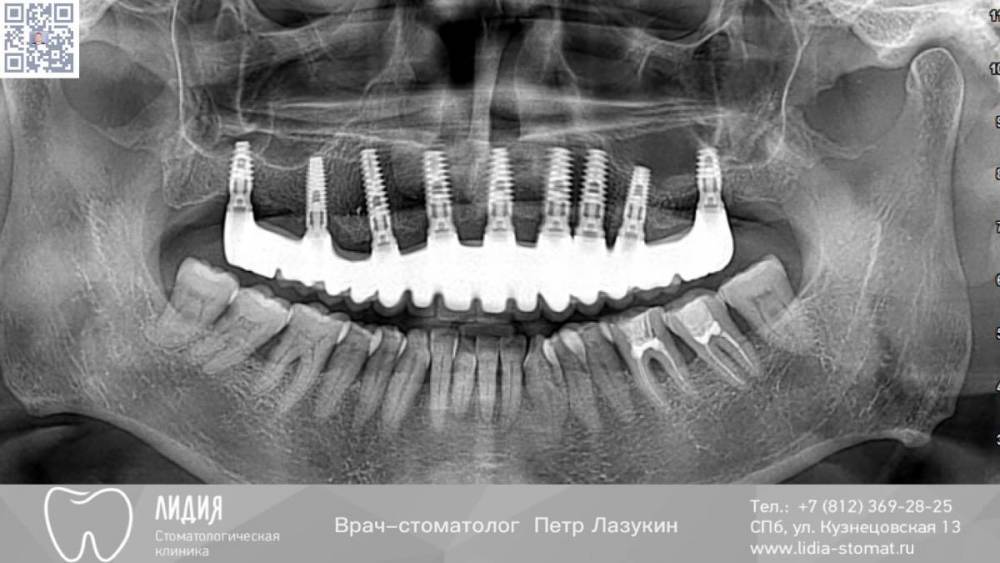 Без названия.009.jpeg