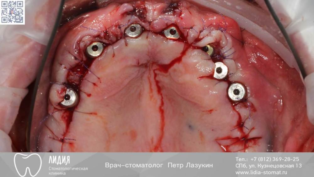 Без названия.004.jpeg