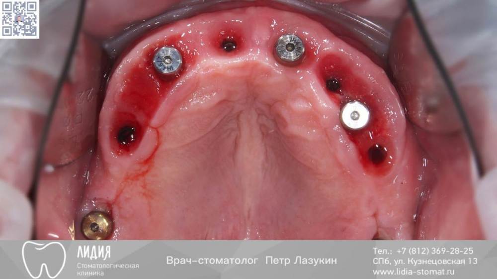 Без названия.006.jpeg