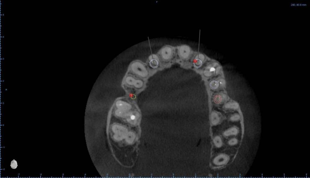 ����� ����� ������������19-Axial View.jpg