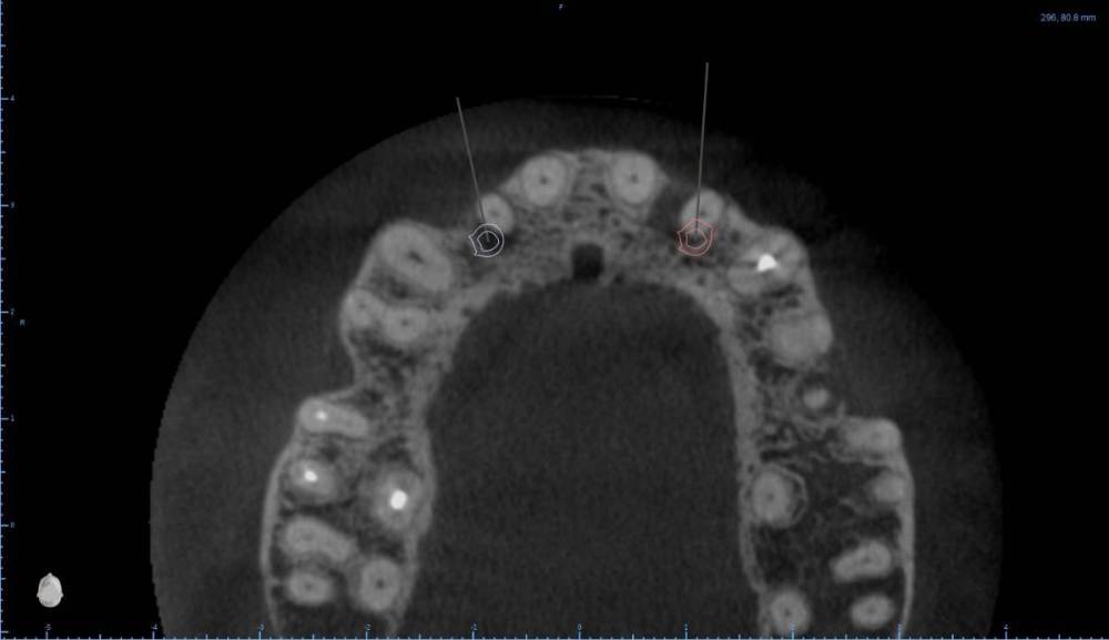 ����� ����� ������������7-Axial View.jpg