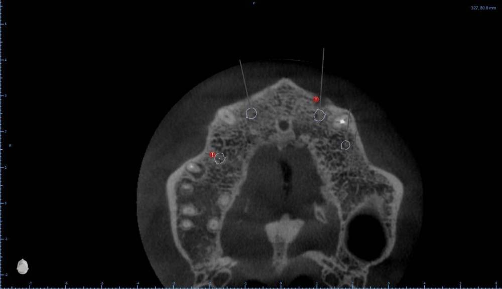 ����� ����� ������������16-Axial View.jpg